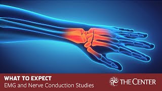 What to Expect During Nerve Conduction Studies and EMG Tests [upl. by Bohlen211]