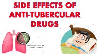 Side effects of Anti Tubercular drugs  RIPE [upl. by Asoral]