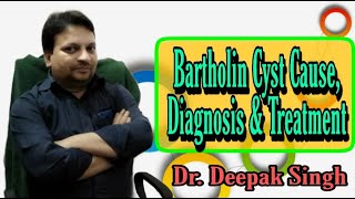 Bartholin Cyst Cause Diagnosis and Treatments  Bartholin Gland Disease  Dr Deepak Singh MSC [upl. by Sibie2]