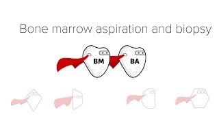 What is aspiration pneumonia [upl. by Refotsirk]