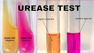 Urea Hydrolysis Urease Test [upl. by Wootten]