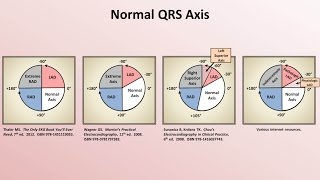 Intro to EKG Interpretation  Rate and Axis [upl. by Armahs857]