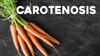 How Too Many Carrots Can Turn Your Skin Orange  Carotenosis  Corporis [upl. by Hugues21]