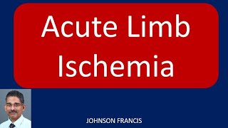 Acute Limb Ischemia [upl. by Barron]