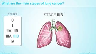 Staging of Lung Cancer [upl. by Gabriellia]