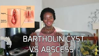 HEALTH ISSUE BARTHOLIN CYST VS ABSCESS UNDERSTANDING THE MEANING CAUSES AND TREATMENTS CHINWE [upl. by Ennovahc]