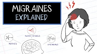 What are Migraines HealthSketch [upl. by Nonie323]