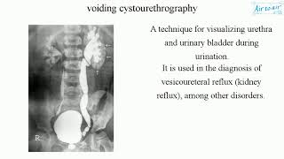 voiding cystourethrography [upl. by Hedberg]