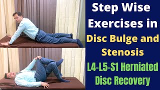 Exercises For Herniated Disc Disc Bulge L4L5S1 Step Wise Treatment for Slipped Disc Recovery [upl. by Enywtna]