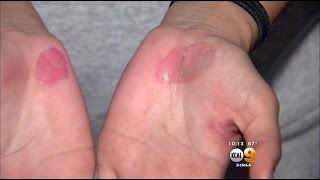 High School Volleyball Coach Fired After Practice On Hot Pavement [upl. by Aibun]