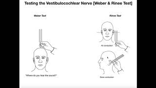 Interpreting the WeberRinne Tests EXPLAINED [upl. by Everard]