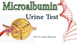 Microalbumin MA Urine Albumin Albumin to Creatinine Ratio [upl. by Evadne426]