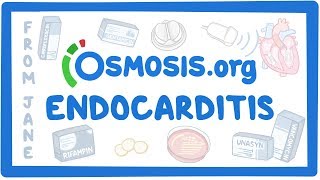 Clinicians Corner Endocarditis [upl. by Ehud]