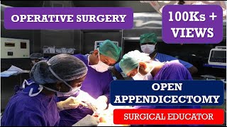 OPEN APPENDECTOMY STEP BY STEP OPERATIVE SURGERY [upl. by Meehyrb110]