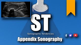 Appendix Ultrasound [upl. by Ilwain378]