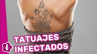 Tatuajes infectados cómo curarlos [upl. by Docila834]