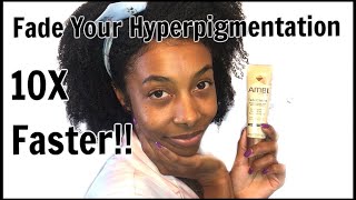 How To REALLY Use Ambi Fade Cream  Fade Hyperpigmentation [upl. by Dilan]