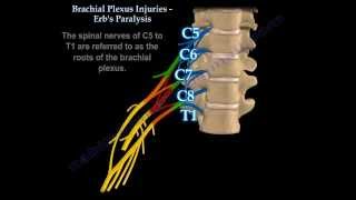 Brachial Plexus Injuries Erbs Paralysis  Everything You Need To Know  Dr Nabil Ebraheim [upl. by Corell]