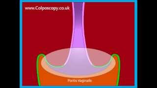 Anatomy of the cervix [upl. by Clower]