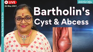 Bartholin Cyst  മലയാളം  Abscess  Symptoms amp Treatment  Marsupalisation   Dr Sita [upl. by Cerellia]