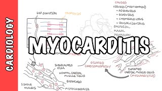 Myocarditis Causes Signs and Symptoms Diagnosis Treatment [upl. by Ettenowtna]