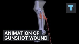 Animation of gunshot wound [upl. by Chun738]