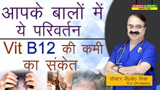 आपके बालों में ये परिवर्तन Vitamin B12 की कमी का संकेत [upl. by Horvitz]