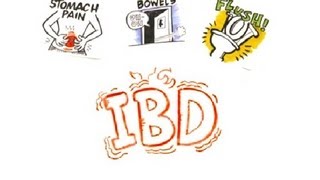 Inflammatory Bowel Disease IBD [upl. by Michale473]