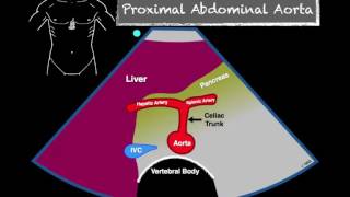 Bedside Ultrasound Abdominal Aorta [upl. by Gaelan695]