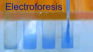 Electroforesis de Proteínas Divulgación científica IQOGCSIC [upl. by Deenya]