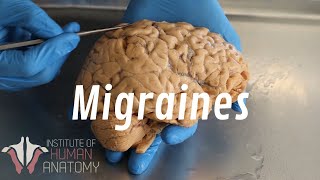 What Are Migraines [upl. by Nolham276]