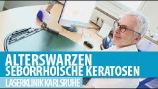 Seborrhoische Keratosen Alterswarzen [upl. by Kenelm]