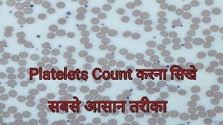 Platelet count under microscope  Platelets Count करना सिखे [upl. by Cobb]