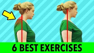 6 Best Exercises For Neck Hump  Get Rid Of Hump On Back Of Neck [upl. by Scotty]