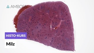 Histologie der Milz  Mikroskopische Anatomie  AMBOSS Video [upl. by Ramsey762]