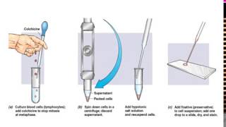 What is Karyotyping [upl. by Zalucki]