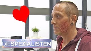 Herzförmige Verbrennung im Gesicht wie ist das passiert  Die Spezialisten  SAT1 TV [upl. by Giamo]