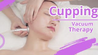 Vacuum Therapy  Vacuum Therapy Cup Massage  Vacuum Cupping Therapy  Lymphatic Drainage [upl. by Ender]