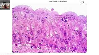 EPITHELIAL TISSUE Practice slides [upl. by Vivie]