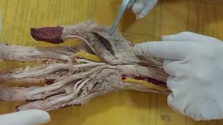 Dissection Muscles of Hand [upl. by Norraf]