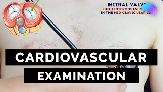 Cardiovascular Examination  OSCE Guide  UKMLA  CPSA  PLAB 2 [upl. by Cyler269]