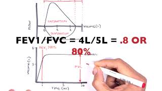 Spirometry Procedure and Results [upl. by Adnolaj]