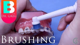 Brushing Your Teeth with Braces [upl. by Grissom]