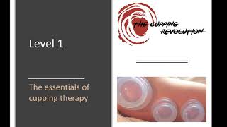 Essentials of Cupping Therapy Free Training [upl. by Nageet16]