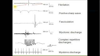 Chapter 2 part 2 Electromyography amp Evoked potentials [upl. by Skier]