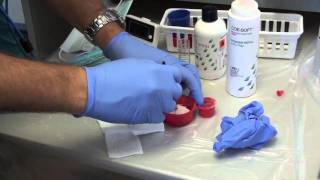 Denture Soft Reline Part 1 [upl. by Dasi]