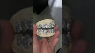 Si Clarity Diamond Grill [upl. by Arretal]