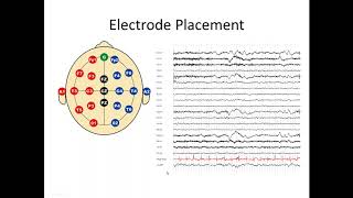 Understanding the EEG [upl. by Hollis]