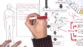 pathophysiology of crohns disease [upl. by Sesylu308]