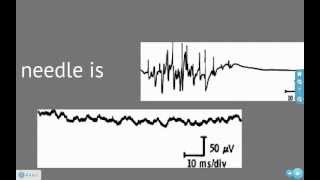 EMG and Action Potentials [upl. by Arenat588]